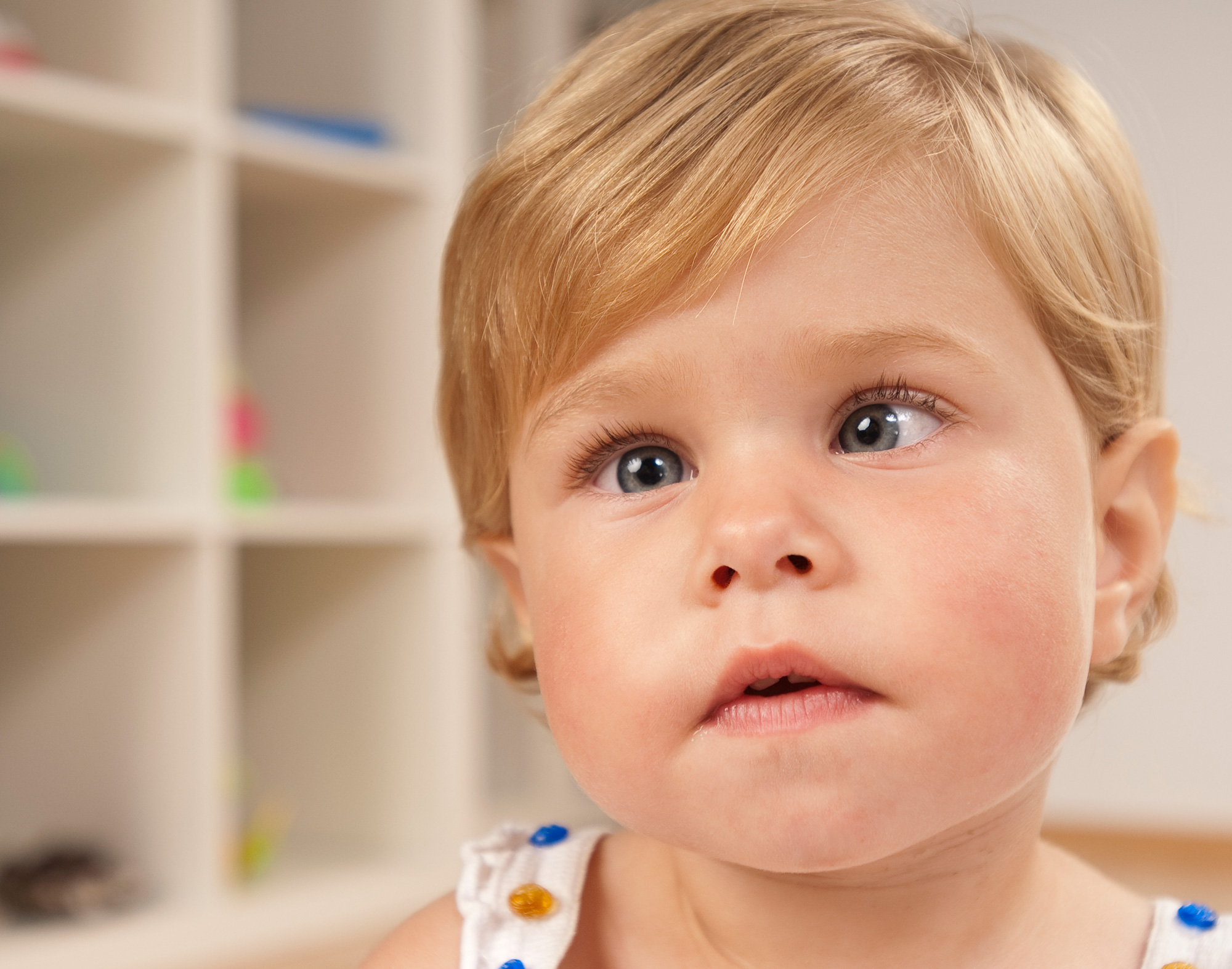 Strabismus Crossed Eyes
